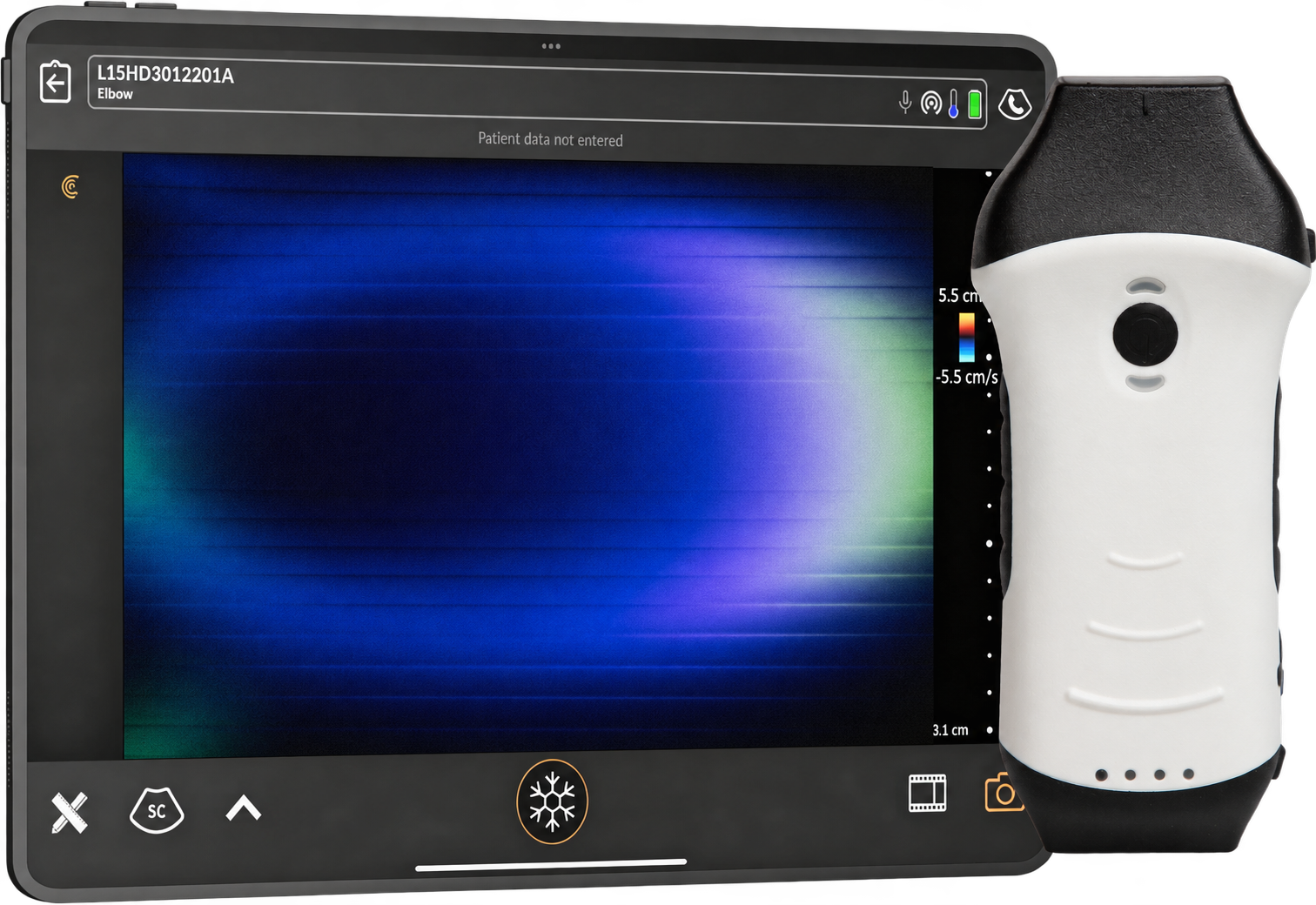 Kuntaide handheld ultrasound product