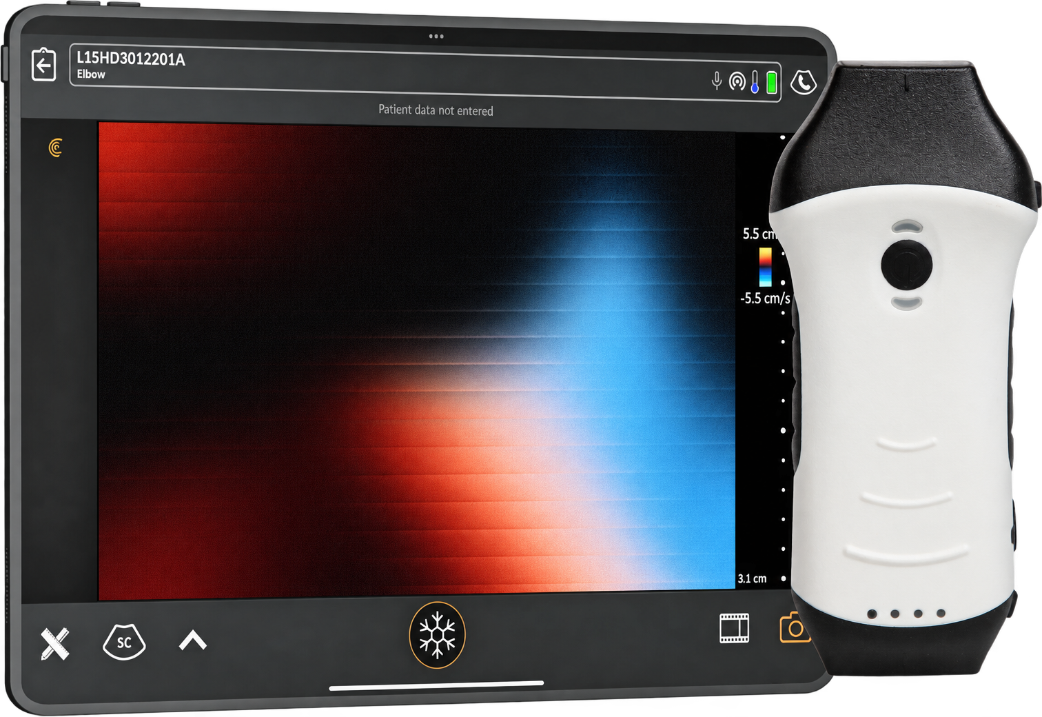 Kuntaide handheld ultrasound product